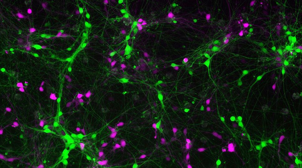 Das Bild zeigt einen Blick durch das Elektronenmikroskop. Zu sehen ist ein schwarzer Hintergrund mit grünen und pinken Farbtupfern. Es handelt sich um eine patientenspezifische Zellkultur aus exzitatorischen (grün) und inhibitorischen (pink) Neuronen.