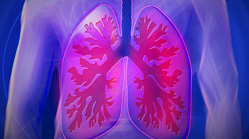 Zeichnung eines menschlichen Oberkörpers - die Lunge ist schematisch hervorgehoben