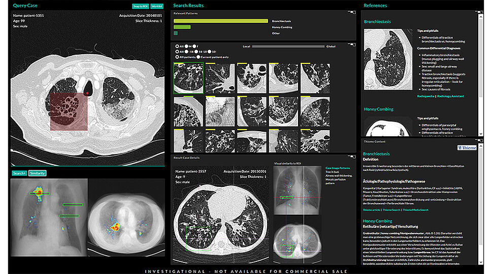 contextflow - Vergleiche von radiologischen 3-D-Bildern