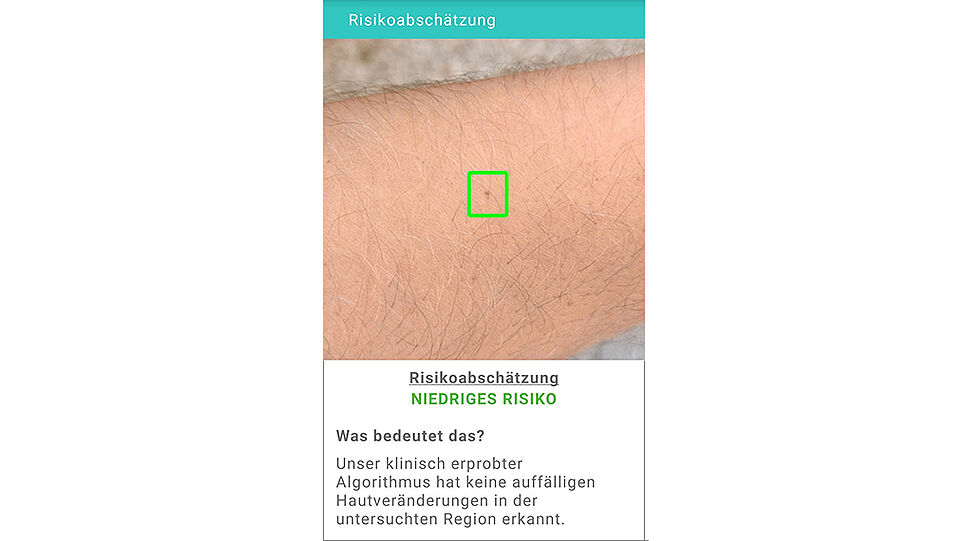 Ausschnitt der SkinScreener Broschüre