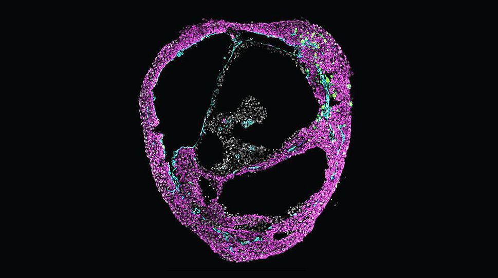 Das Bild zeigt einen Querschnitt durch ein Herzorganoid. Die Organoide enthalten die wichtigsten Zellarten des menschlichen Herzens wie Herzmuskelzellen, Herzblutgefäßzellen und Herzbindegewebszellen (im Bild farblich unterschieden) und entwickeln die kammerartige Struktur des Herzens (im Bild ein schwarzer Hohlraum).