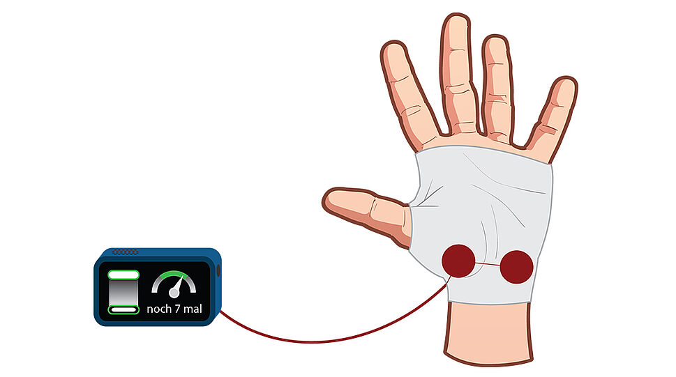 Gezeichnete Hand mit Fortix-Handschuh, verbunden mit Hardwarekomponente