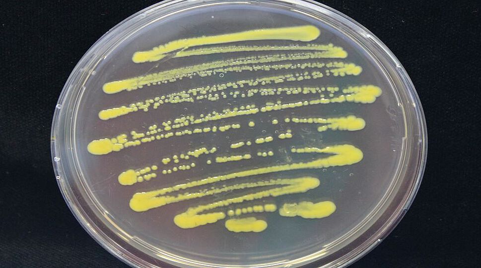 Auf dem Bild sieht man eine Petrischale mit Bakterienauftrag. Die Ausscheidungen der Mikroorganismen zeigen sich in deutlich sichtbaren leuchtend gelben Farbtupfer